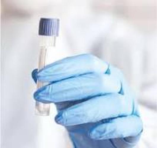 Cваб (Буферная пептонная вода) - Compact Dry Swab (BPW) фото 2