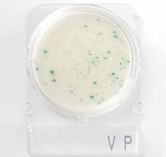 Подложки парагемолитический вибрион - Compact Dry VP